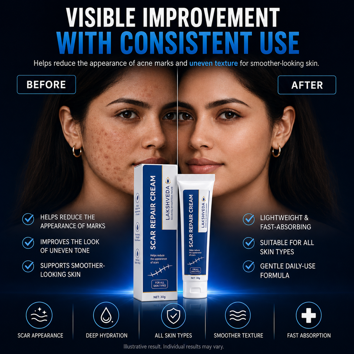 ScarSmooth™- Great for all types of marks ( Buy 1 Get 1 Free )