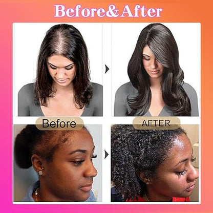2 Bottles Raw Batana Oil for Hair Growth 100g Each